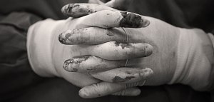 India_SurgeonsHands_WEB